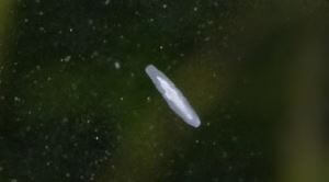 platworm (rhabdoecoela)